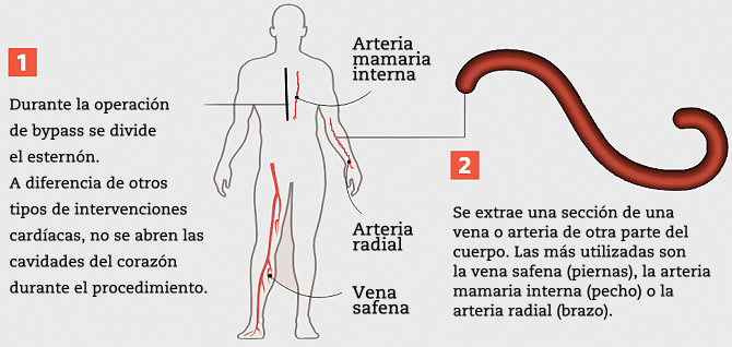 arteria femoral
