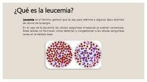 Leucemia-1