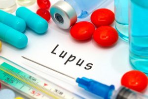 tratamientos del lupus