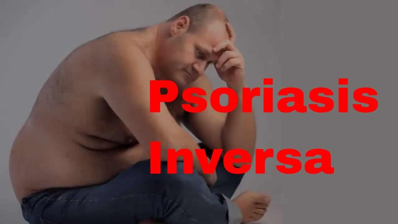Psoriasis inversa