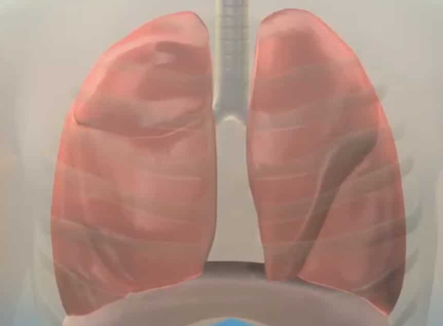 Cambios en la estructura pulmonar
